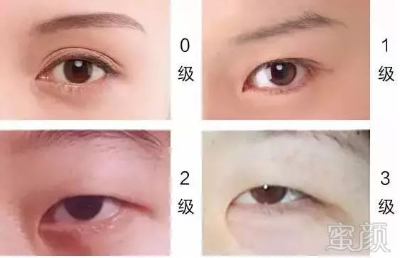 https://img.miyanlife.com/mnt/timg/171031/14245QI6-2.jpg