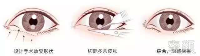 https://img.miyanlife.com/mnt/timg/171031/14245W347-4.jpg