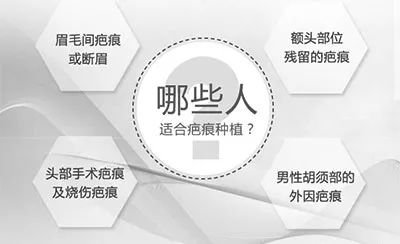 https://img.miyanlife.com/mnt/timg/171031/144K95I0-1.jpg