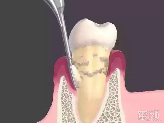 https://img.miyanlife.com/mnt/timg/171031/15032311P-4.jpg