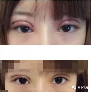 https://img.miyanlife.com/mnt/timg/171101/102PSH2-1.jpg