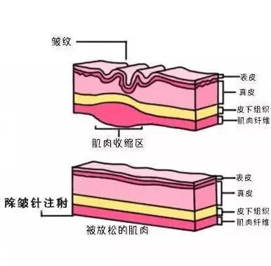https://img.miyanlife.com/mnt/timg/171101/11112Q2X-4.jpg