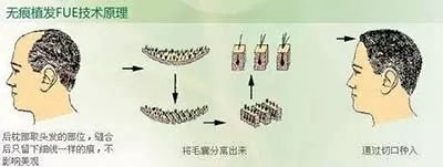 https://img.miyanlife.com/mnt/timg/171101/1141563648-1.jpg