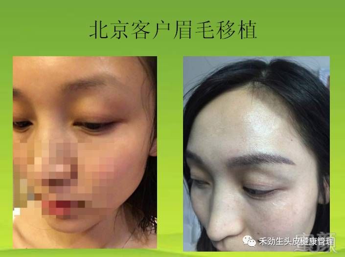 https://img.miyanlife.com/mnt/timg/171101/1150591111-5.jpg