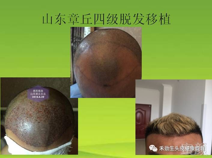 https://img.miyanlife.com/mnt/timg/171101/1151003627-7.jpg