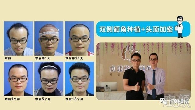 https://img.miyanlife.com/mnt/timg/171101/1152225c0-7.jpg