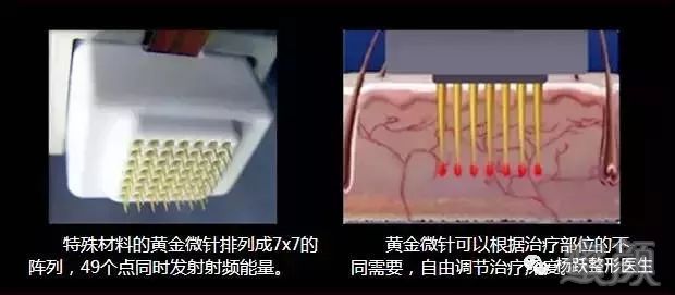 案例图片