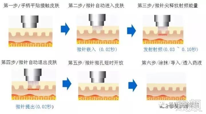 案例图片