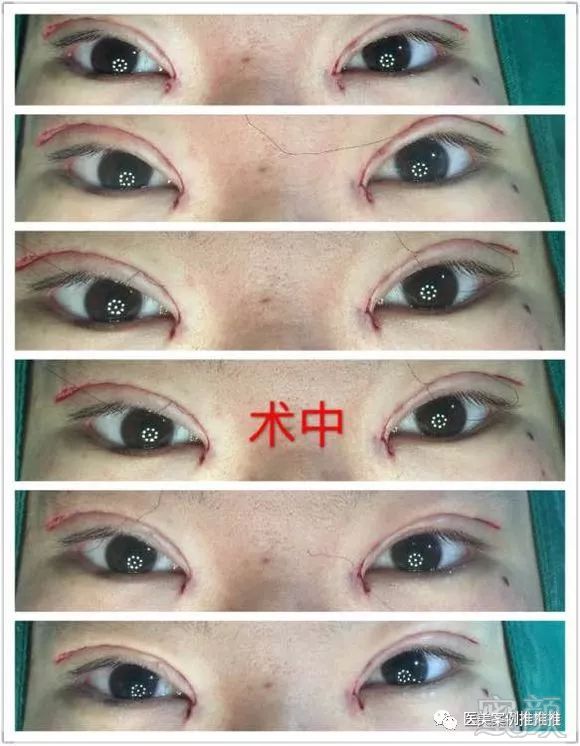 https://img.miyanlife.com/mnt/timg/171101/1219232133-1.jpg
