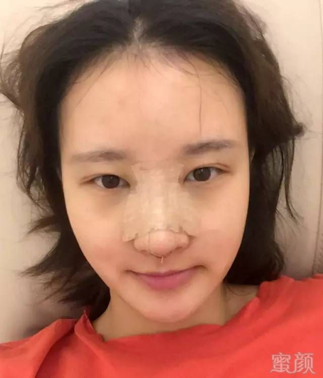 https://img.miyanlife.com/mnt/timg/171101/122F05536-10.jpg