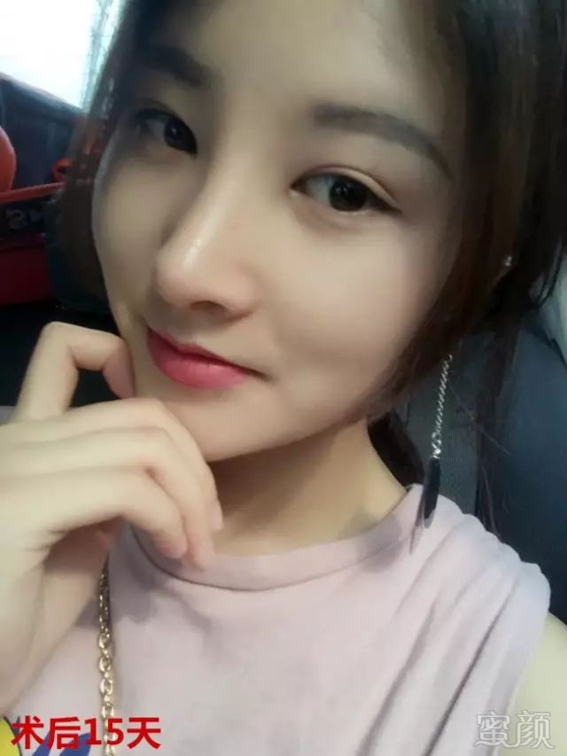 https://img.miyanlife.com/mnt/timg/171101/122F11937-15.jpg