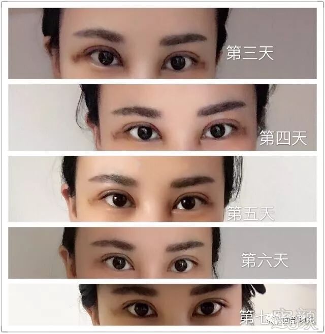 https://img.miyanlife.com/mnt/timg/171101/12342QK0-0.jpg
