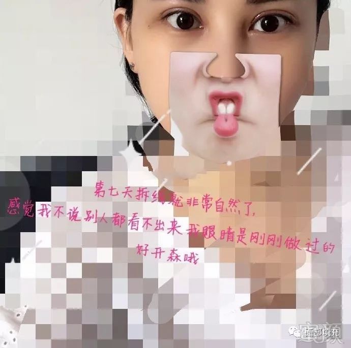 https://img.miyanlife.com/mnt/timg/171101/12342RC6-1.jpg