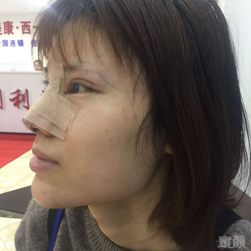 https://img.miyanlife.com/mnt/timg/171101/12344aJ4-5.jpg