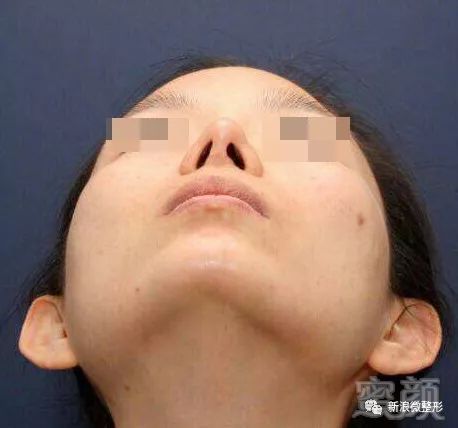 https://img.miyanlife.com/mnt/timg/171102/112R46493-2.jpg