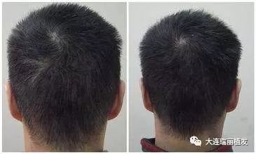 https://img.miyanlife.com/mnt/timg/171102/1234563092-2.jpg