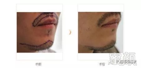 https://img.miyanlife.com/mnt/timg/171102/12533644V-1.jpg