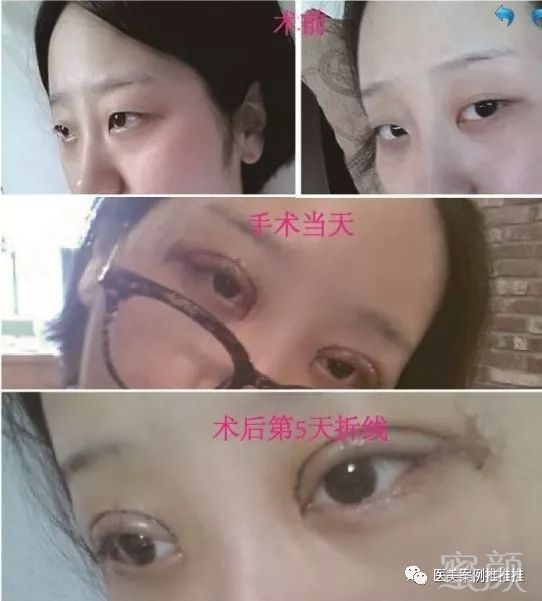https://img.miyanlife.com/mnt/timg/171102/12555433A-0.jpg