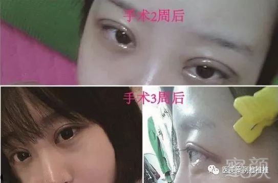 https://img.miyanlife.com/mnt/timg/171102/1255545E2-1.jpg