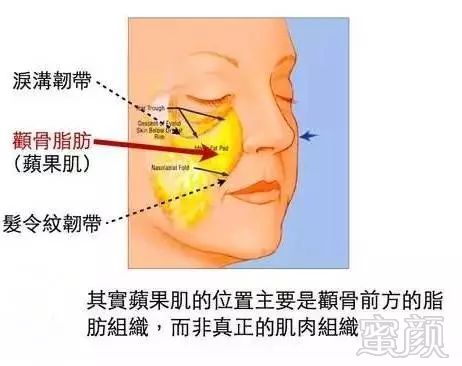 案例图片