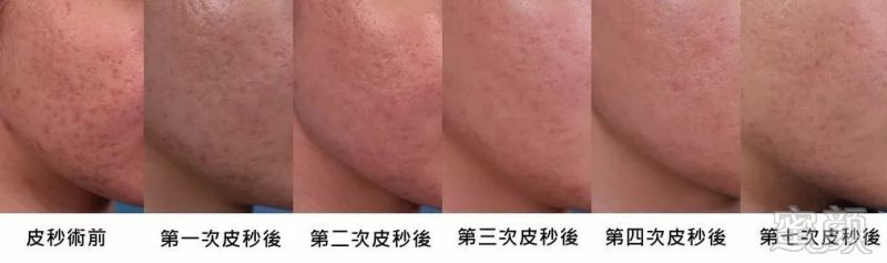 https://img.miyanlife.com/mnt/timg/171103/125I912S-11.jpg