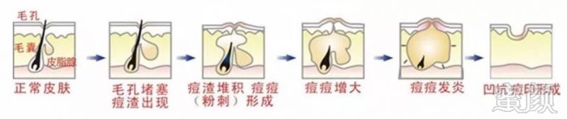 https://img.miyanlife.com/mnt/timg/171103/125IHP7-1.jpg