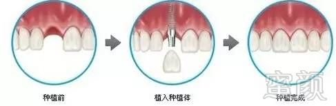 https://img.miyanlife.com/mnt/timg/171103/1322142X0-1.jpg