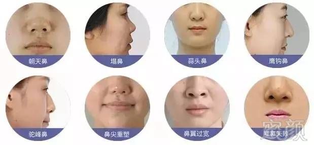 https://img.miyanlife.com/mnt/timg/171103/1355216033-3.jpg