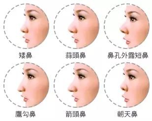 https://img.miyanlife.com/mnt/timg/171103/135522GF-9.jpg