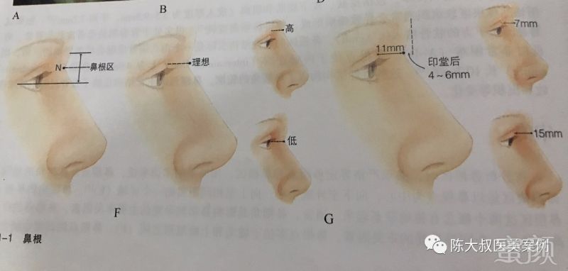 https://img.miyanlife.com/mnt/timg/171103/14255511D-1.jpg