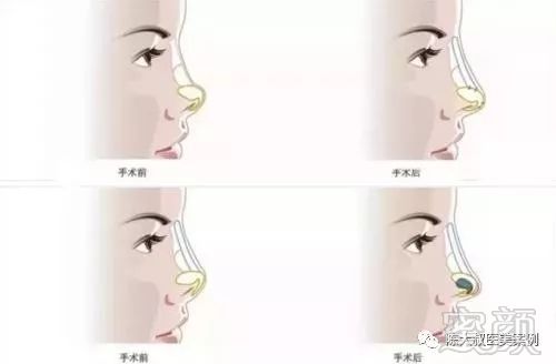 https://img.miyanlife.com/mnt/timg/171103/14255G560-9.jpg