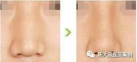 https://img.miyanlife.com/mnt/timg/171103/14255GK8-8.jpg