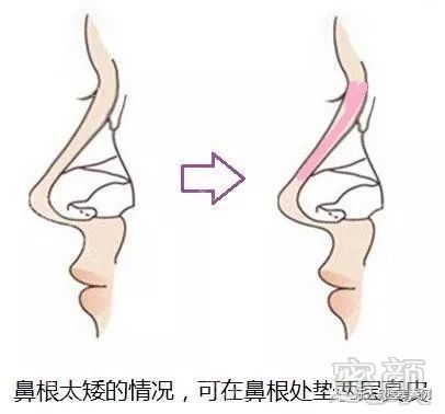 https://img.miyanlife.com/mnt/timg/171103/14255I064-7.jpg