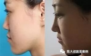 https://img.miyanlife.com/mnt/timg/171103/14255L3Q-10.jpg