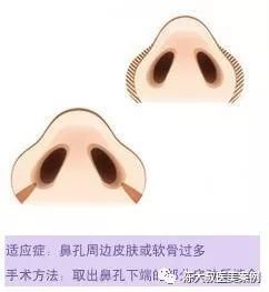 https://img.miyanlife.com/mnt/timg/171103/14255V428-11.jpg