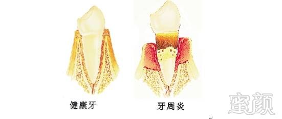 案例图片