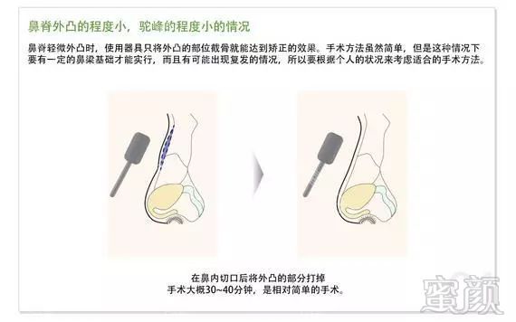 案例图片