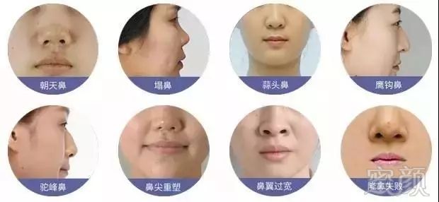 https://img.miyanlife.com/mnt/timg/171104/1041301955-4.jpg