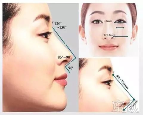 https://img.miyanlife.com/mnt/timg/171104/1041304B9-3.jpg