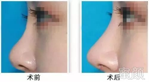 https://img.miyanlife.com/mnt/timg/171104/1041315V4-8.jpg