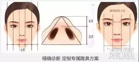 https://img.miyanlife.com/mnt/timg/171104/1041316057-11.jpg