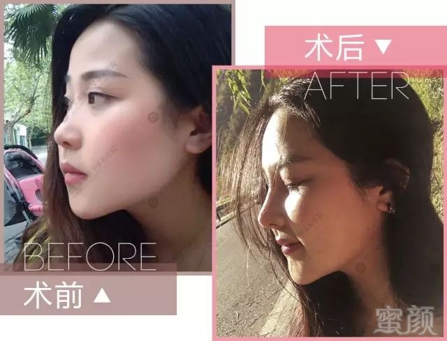 https://img.miyanlife.com/mnt/timg/171104/114154O35-15.jpg