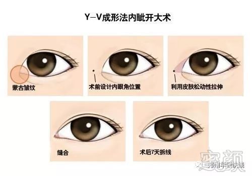https://img.miyanlife.com/mnt/timg/171104/122ZU201-1.jpg