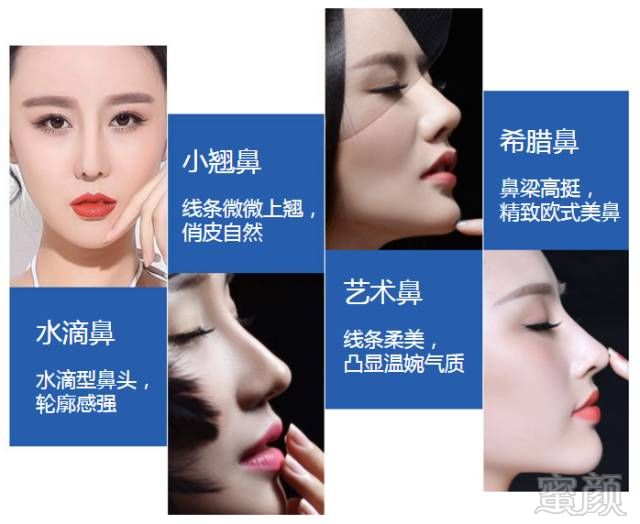 https://img.miyanlife.com/mnt/timg/171105/12132A540-7.jpg