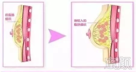 https://img.miyanlife.com/mnt/timg/171105/122A21b6-2.jpg