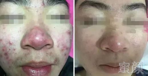 https://img.miyanlife.com/mnt/timg/171105/1230131507-14.jpg