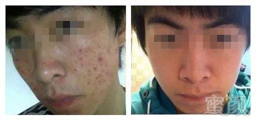 https://img.miyanlife.com/mnt/timg/171105/123FIP3-8.jpg