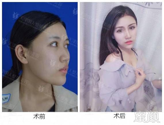 https://img.miyanlife.com/mnt/timg/171105/1419443928-1.jpg