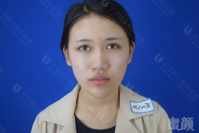 https://img.miyanlife.com/mnt/timg/171105/1419444V1-2.jpg