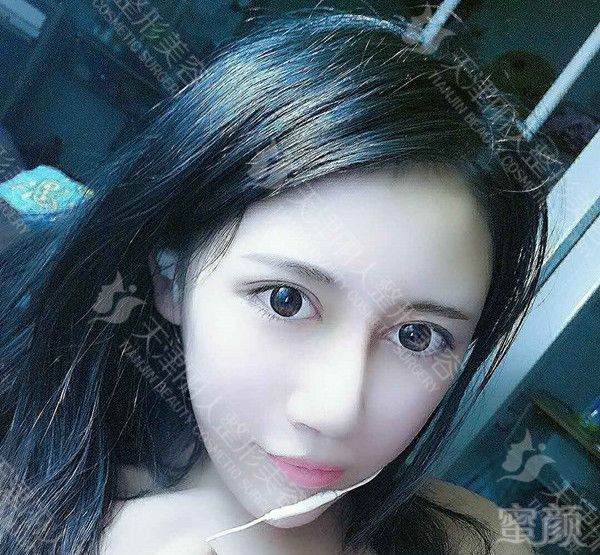 https://img.miyanlife.com/mnt/timg/171105/141945B43-5.jpg